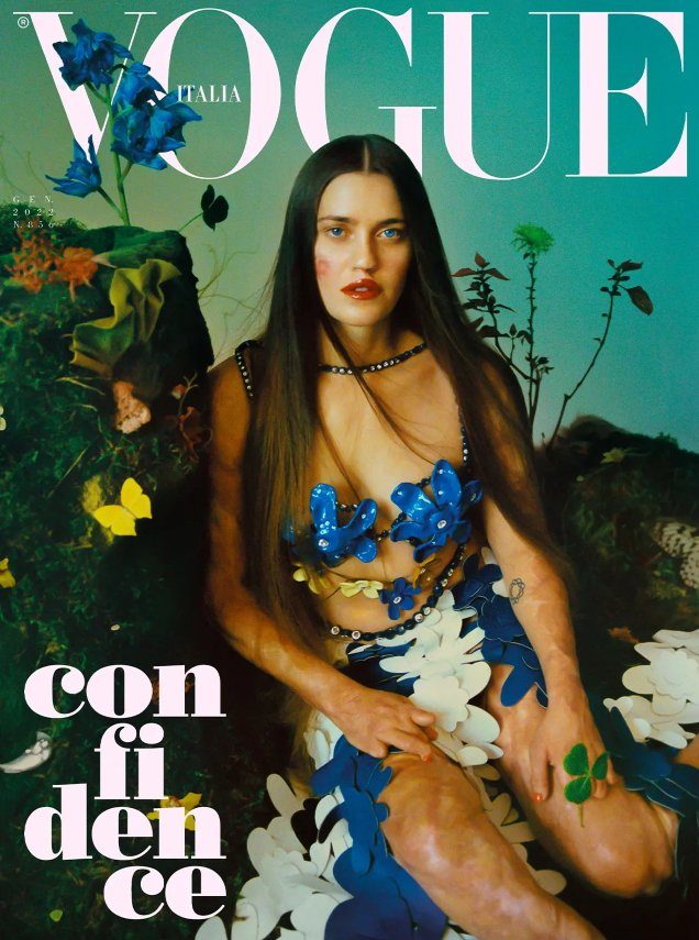Paralympian Veronica Yoko Plebani Covers Vogue Italia’s January 2022 Issue