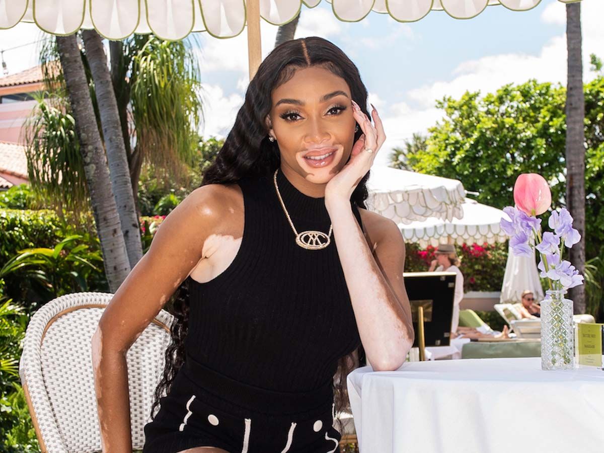 Winnie Harlow Wore the Two-Piece H&M Set You’ll Want to Wear 24/7 This Summer