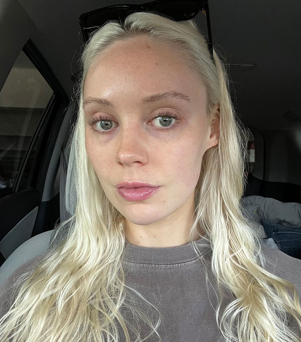 I Got a Cryofacial, and Multiple Strangers Chased Me Down for My Skin Secrets