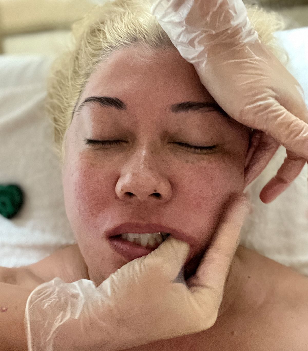 I Tried the Buccal Facial Massage Celebrities Like Meghan Markle Love