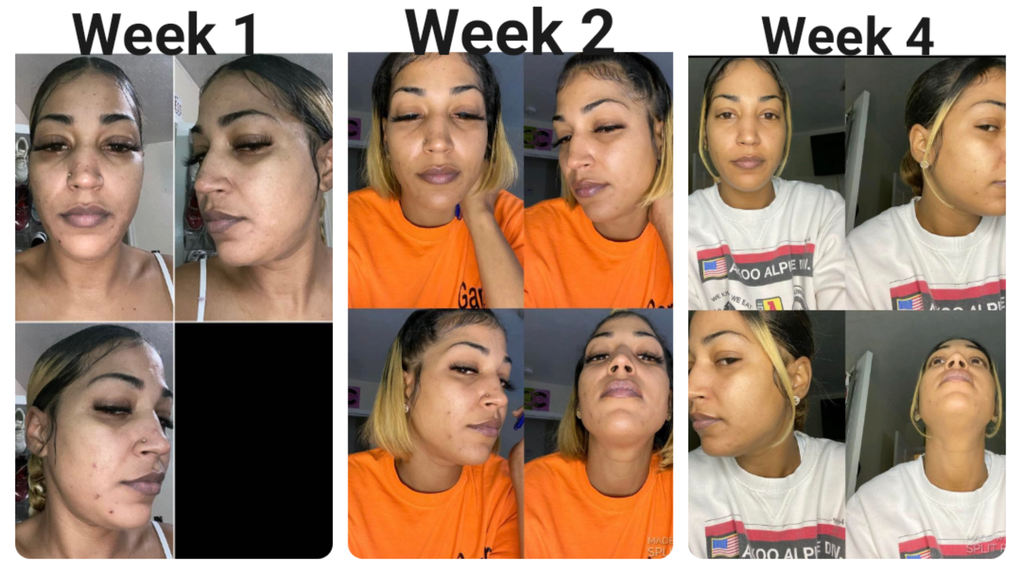 Skin Miracle Unveiled: Watch How This Natural Elixir Transforms Problematic Skin!