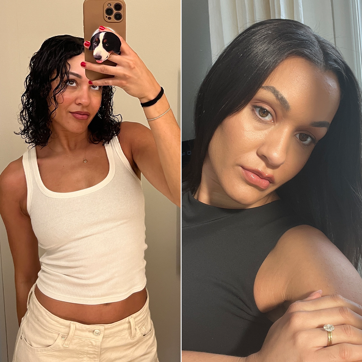 Hair Loss After Stopping the Birth Control Pill: What Helped Me